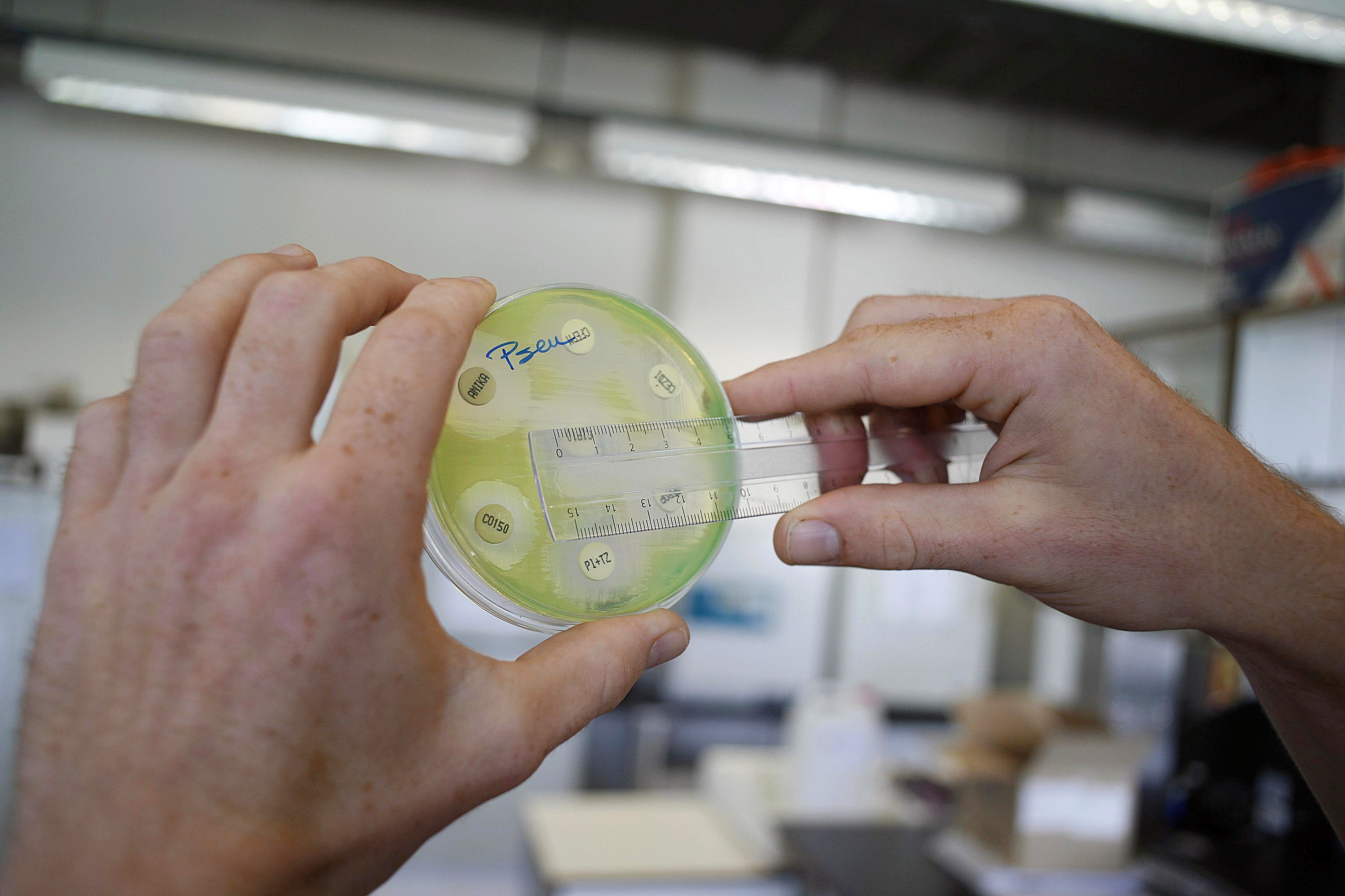 Bacteria mortal escapa de laboratorio en Luisiana